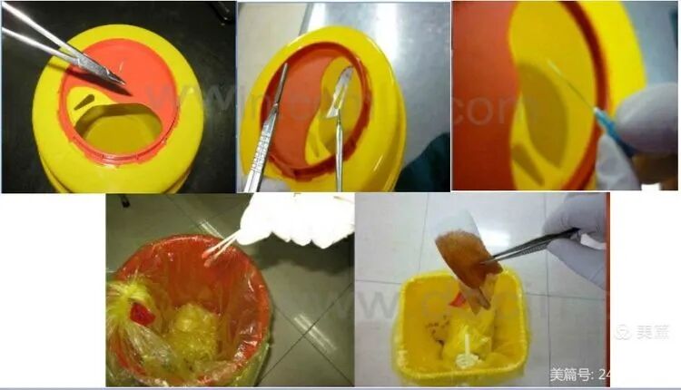 导尿包怎么清洗复用器械的预处理_https://www.jmylbn.com_新闻资讯_第16张