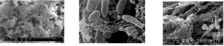 导尿包怎么清洗复用器械的预处理_https://www.jmylbn.com_新闻资讯_第5张
