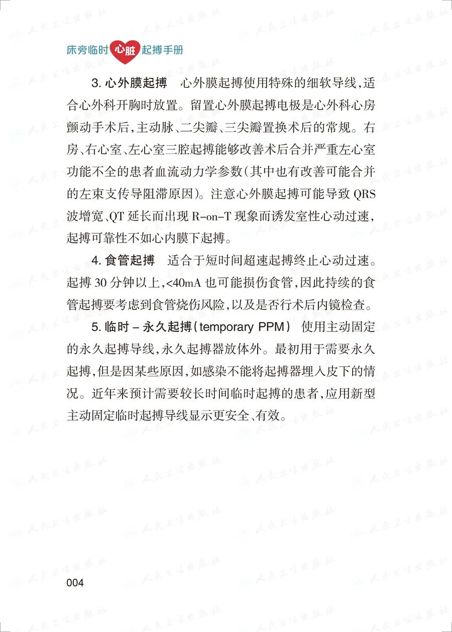 床旁心电图怎么做预售 ｜ 床旁临时心脏起搏手册，手把手教会起搏技术！_https://www.jmylbn.com_新闻资讯_第18张
