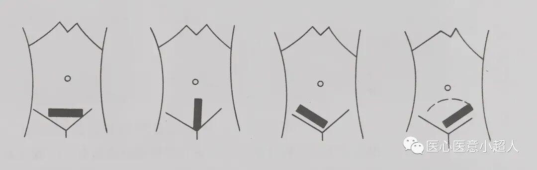 彩超探头怎么消毒妇科彩超探测的途径与方法_https://www.jmylbn.com_新闻资讯_第1张