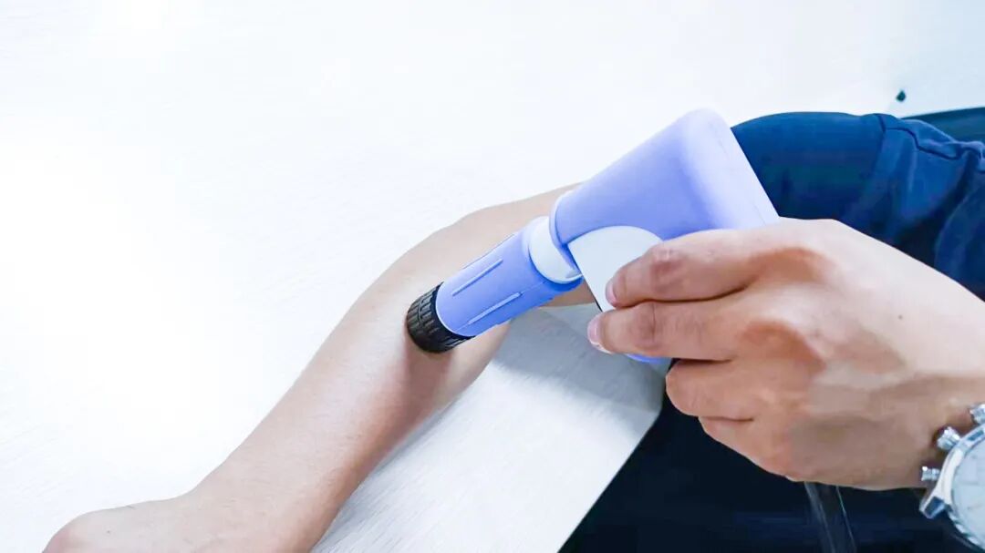 冲击波治疗效果怎么样体外冲击波治疗颈肩腰腿痛效果好_https://www.jmylbn.com_新闻资讯_第5张