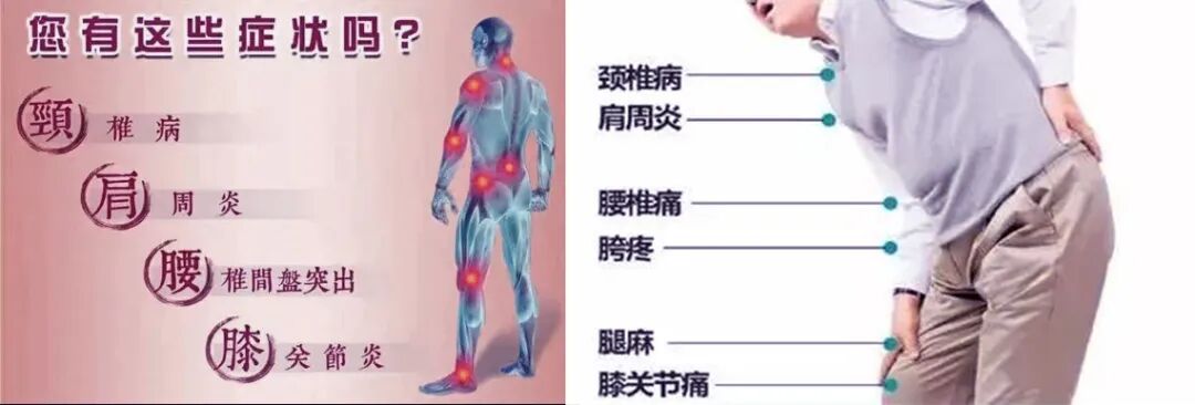 冲击波治疗效果怎么样体外冲击波治疗颈肩腰腿痛效果好_https://www.jmylbn.com_新闻资讯_第1张