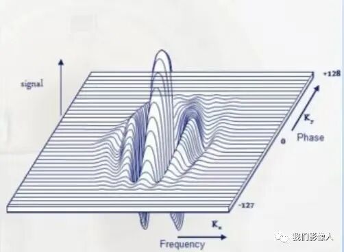 磁共振矩阵怎么计算磁共振——参数篇—（信噪比）_https://www.jmylbn.com_新闻资讯_第7张