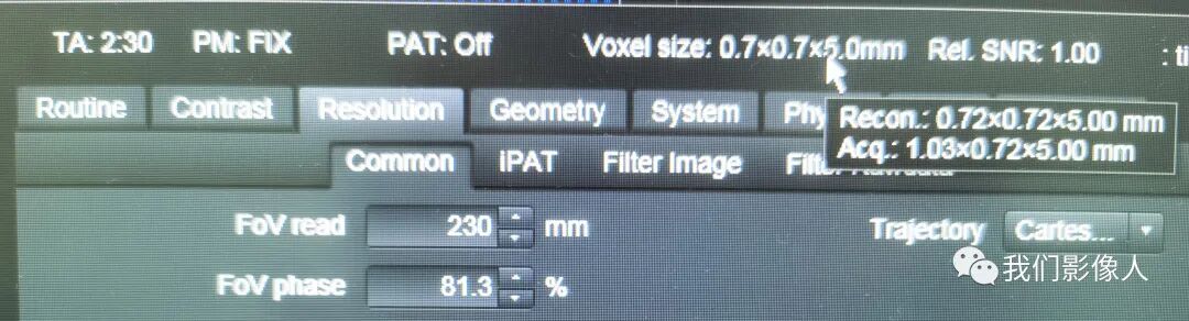 磁共振矩阵怎么计算磁共振——参数篇—（信噪比）_https://www.jmylbn.com_新闻资讯_第6张