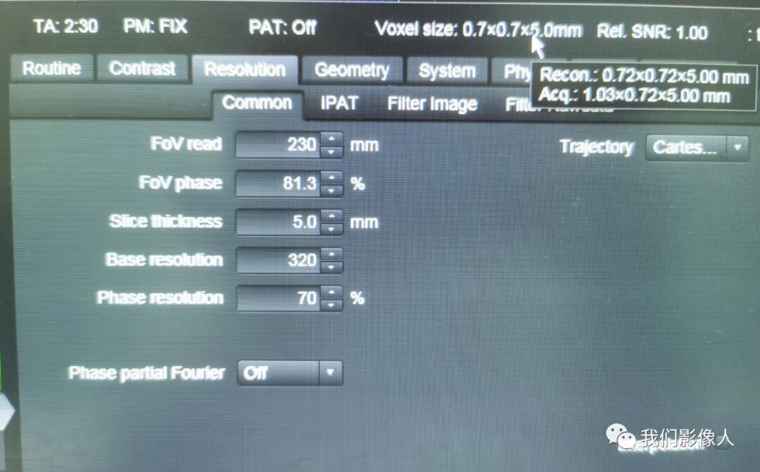 磁共振矩阵怎么计算磁共振——参数篇—（信噪比）_https://www.jmylbn.com_新闻资讯_第5张