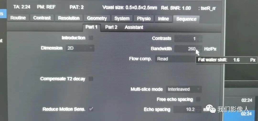 磁共振矩阵怎么计算磁共振——参数篇—（信噪比）_https://www.jmylbn.com_新闻资讯_第10张