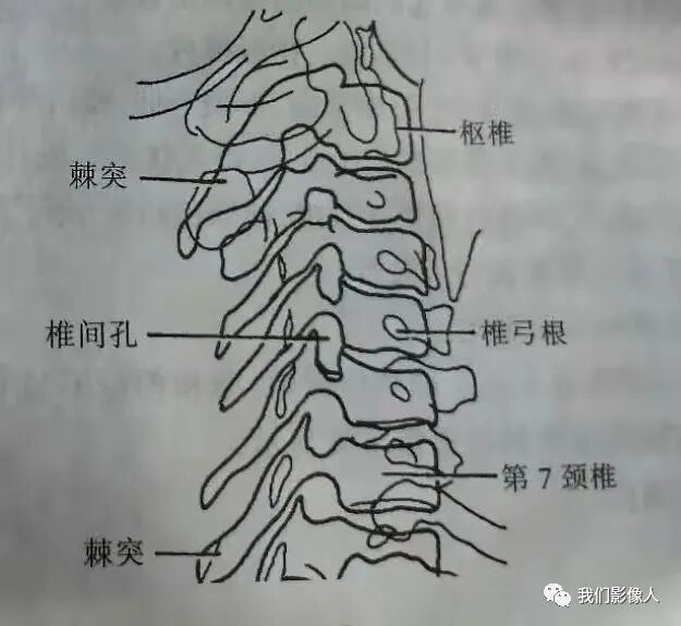 dr摆位看什么书颈、腰椎DR斜位检查探讨-上海聚慕医疗器械有限公司