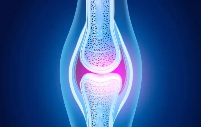 正常关节里有“水”吗？关节腔积液的症状？