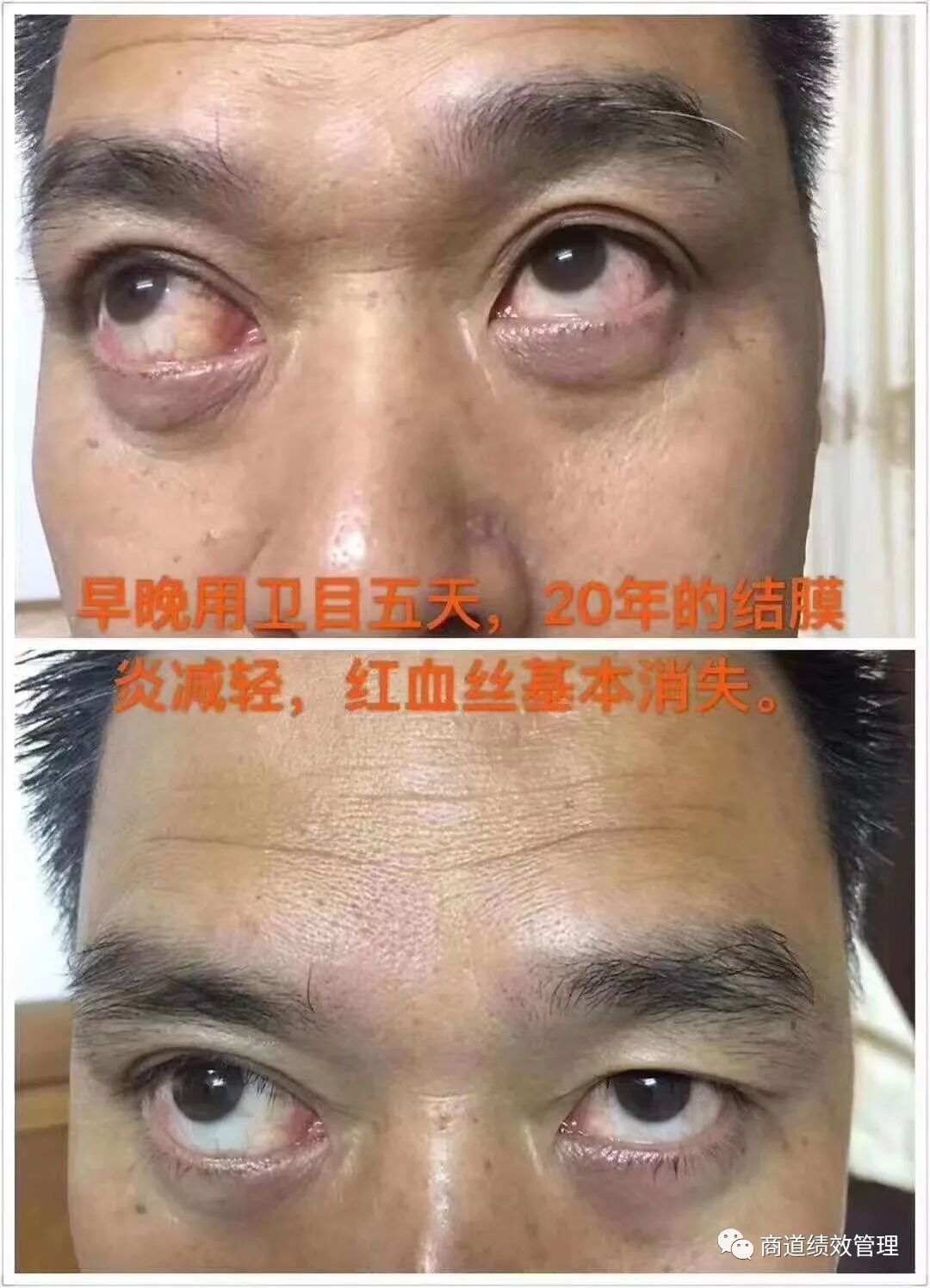 卫目世明产品案例,卫目世明产品效果怎么样?