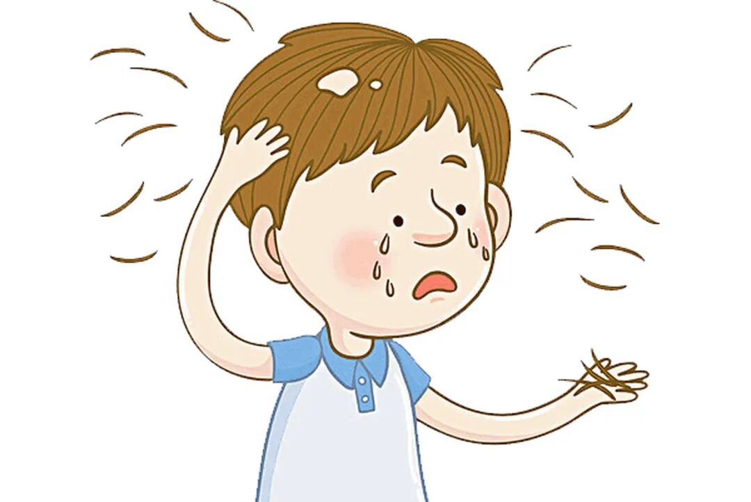 成都皮肤医院哪家好？小孩也会患斑秃吗？原因为何--成都皮肤病医院—成都皮肤医院—成都皮肤病科医院—成都皮肤科排名—成都皮肤病医院