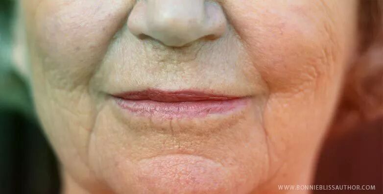 收缩会慢慢积累造成嘴角纹,有时候还会跟法令纹形成一个嘴周的括号