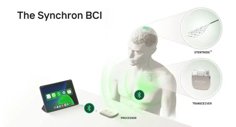 Synchron Debuts First Thought-Controlled iPad Experience | Medical Product  Outsourcing