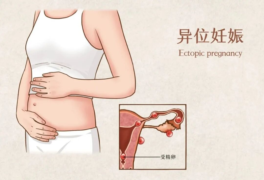 妇科脉冲怎么回事治疗过半，患者来退费，原因竟是……_https://www.jmylbn.com_新闻资讯_第5张