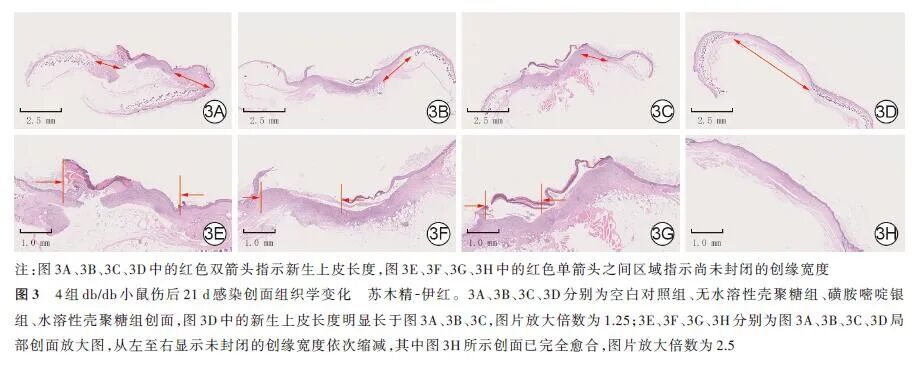 创面修复抗菌敷料怎么用论著 · 生物材料在创面修复中的应用｜水溶性壳聚糖凝胶敷料对糖尿病小鼠感染创面愈合作用及机制的研究_https://www.jmylbn.com_新闻资讯_第8张
