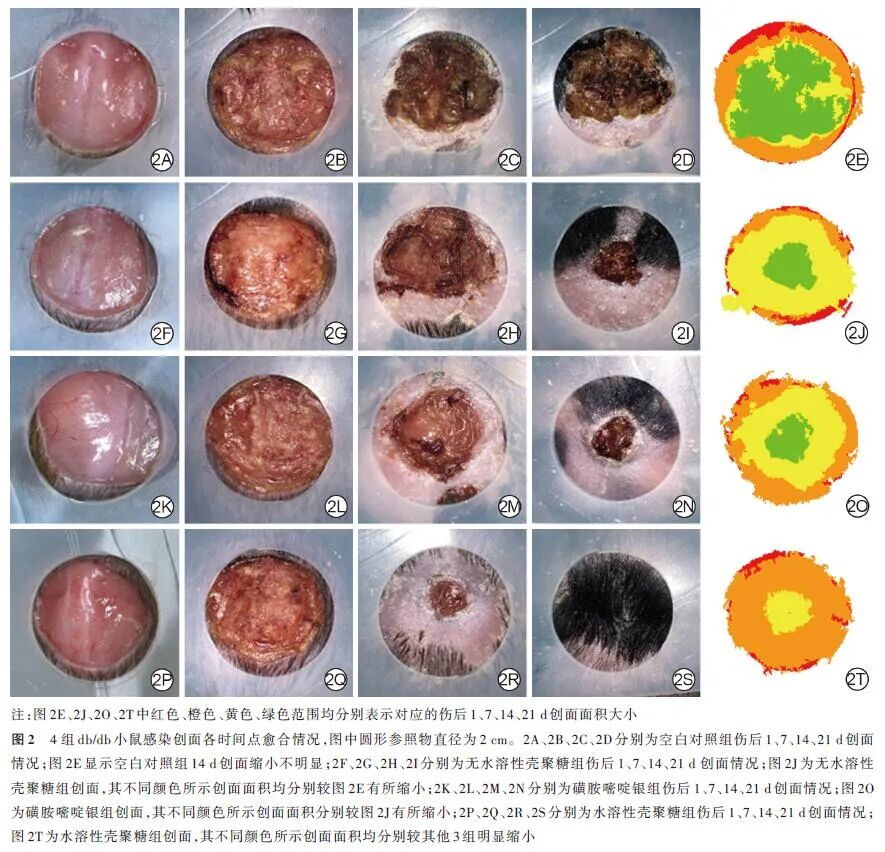 创面修复抗菌敷料怎么用论著 · 生物材料在创面修复中的应用｜水溶性壳聚糖凝胶敷料对糖尿病小鼠感染创面愈合作用及机制的研究_https://www.jmylbn.com_新闻资讯_第6张