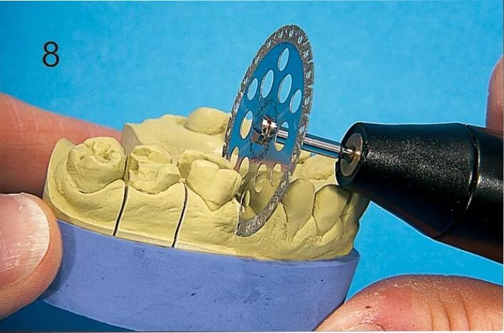 打造完美义齿标模诚荐德国比丹树脂石膏