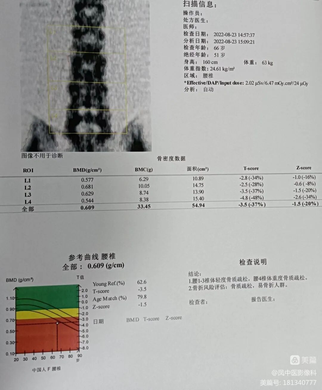 双能x骨密度检测仪为什么非得输入体重身高双能X线骨密度检测： 诊断骨质疏松的“金标准”_https://www.jmylbn.com_新闻资讯_第4张