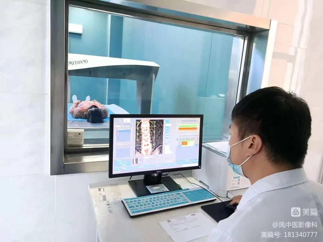 双能x骨密度检测仪为什么非得输入体重身高双能X线骨密度检测： 诊断骨质疏松的“金标准”_https://www.jmylbn.com_新闻资讯_第3张