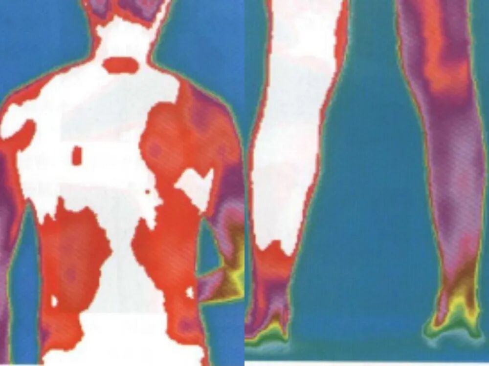 医用红外热像仪怎么开机中医“CT”——红外热像仪_https://www.jmylbn.com_新闻资讯_第6张