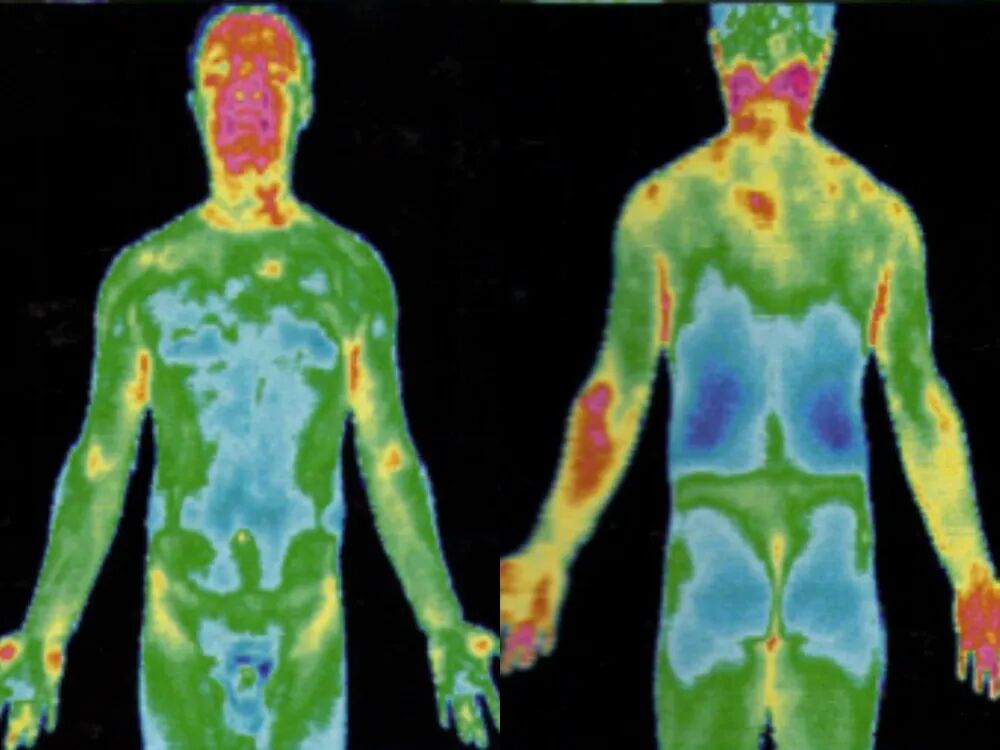 医用红外热像仪怎么开机中医“CT”——红外热像仪_https://www.jmylbn.com_新闻资讯_第3张