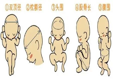 眼科ab超单怎么看孕妇的B超单怎么看？13个指标详细解析，孕妈妈轻松看懂B超单_https://www.jmylbn.com_新闻资讯_第4张