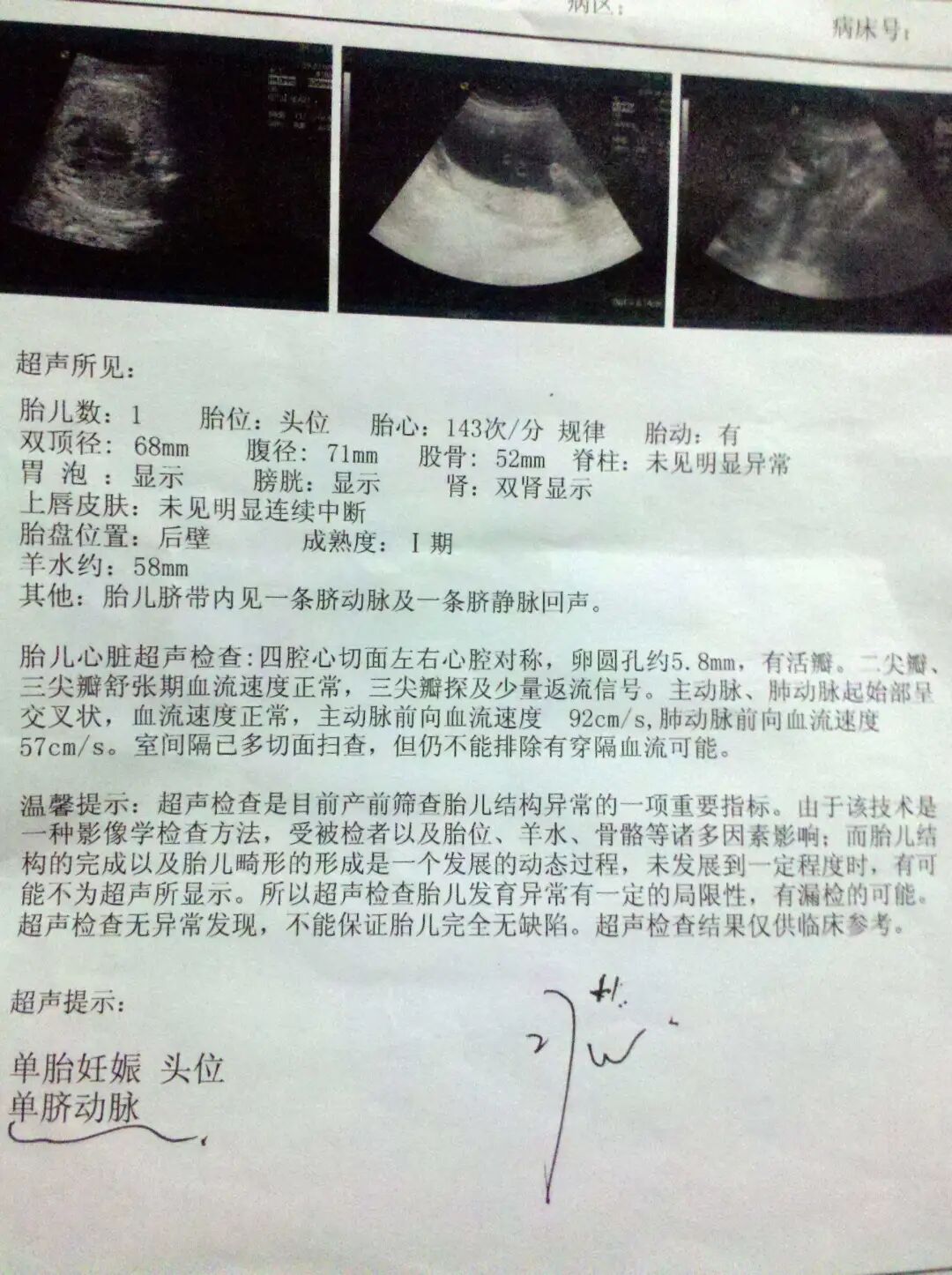 眼科ab超单怎么看孕妇的B超单怎么看？13个指标详细解析，孕妈妈轻松看懂B超单_https://www.jmylbn.com_新闻资讯_第8张