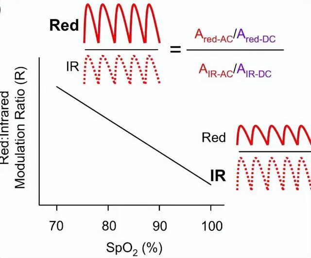 血氧探头是干什么用的您了解血氧仪吗？血氧仪知识大全~_https://www.jmylbn.com_新闻资讯_第13张