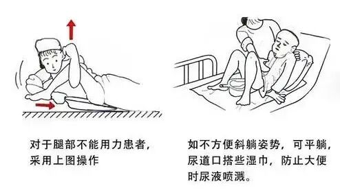 病人移位带怎么用骨科卧床患者床上排便不用愁_https://www.jmylbn.com_新闻资讯_第3张