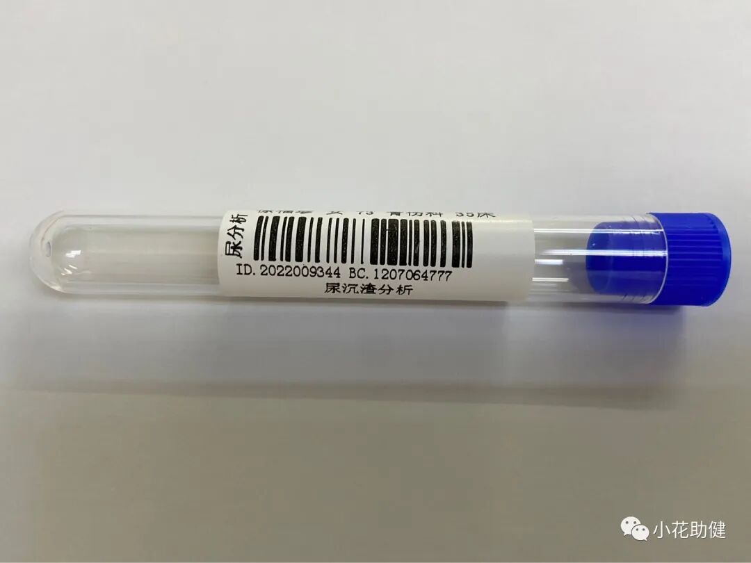 采血管分别采什么血静脉采血管的选择及注意事项_https://www.jmylbn.com_新闻资讯_第13张