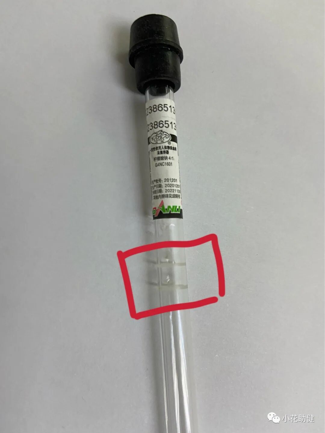 采血管分别采什么血静脉采血管的选择及注意事项_https://www.jmylbn.com_新闻资讯_第9张