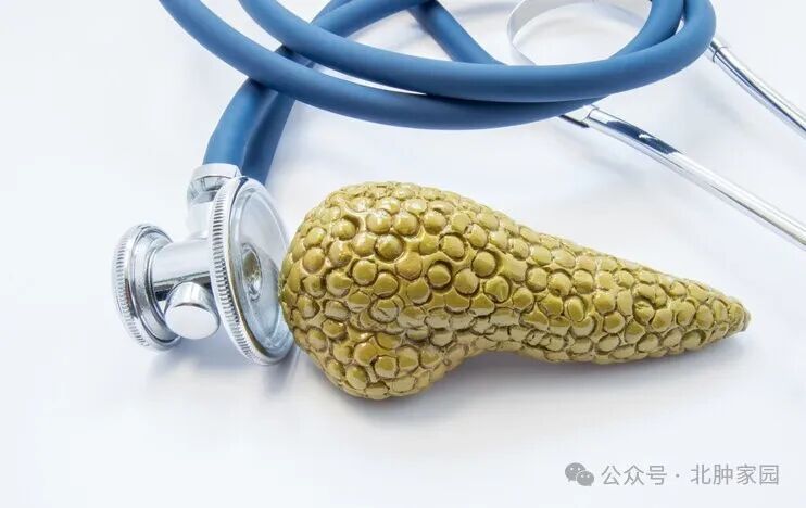 胰腺癌一发现就是晚期，生存率极低！胰腺癌为什么这么可怕？