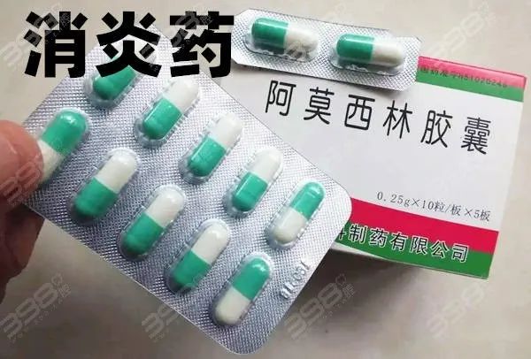 口服消炎药物