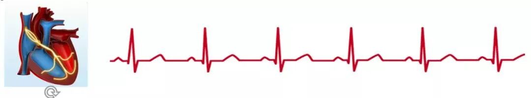 心脏检测仪怎么看中国房颤日｜ 穿戴式心电检测仪，心脏的守护神！（内有福利）_https://www.jmylbn.com_新闻资讯_第3张