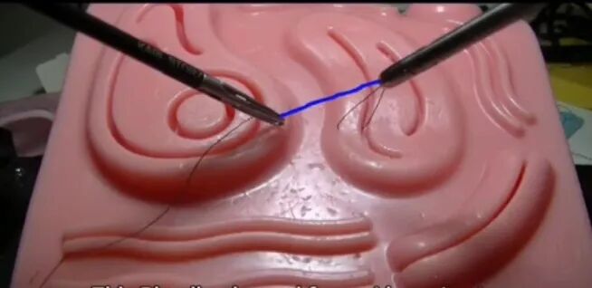 缝合时怎么持钳腹腔镜手术之缝合打结_https://www.jmylbn.com_新闻资讯_第1张