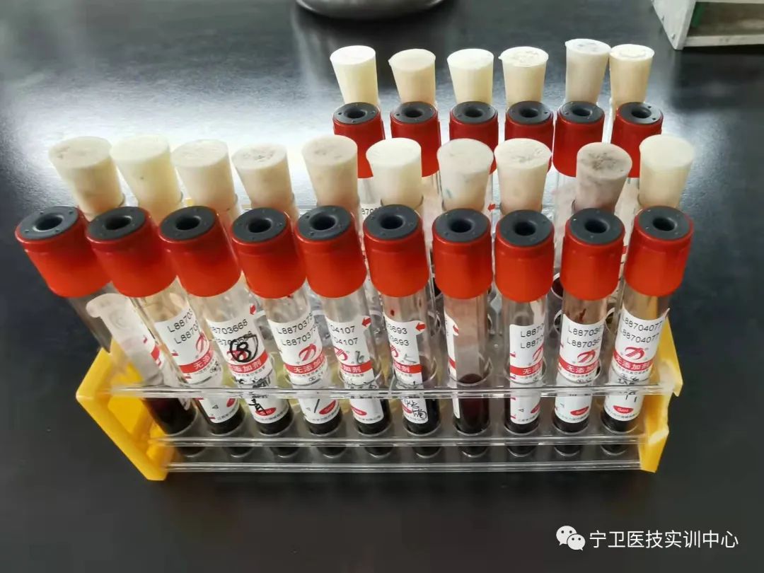 （注：有15位同学参与抽血（其中一位同学多抽了一管血），实际标本数量