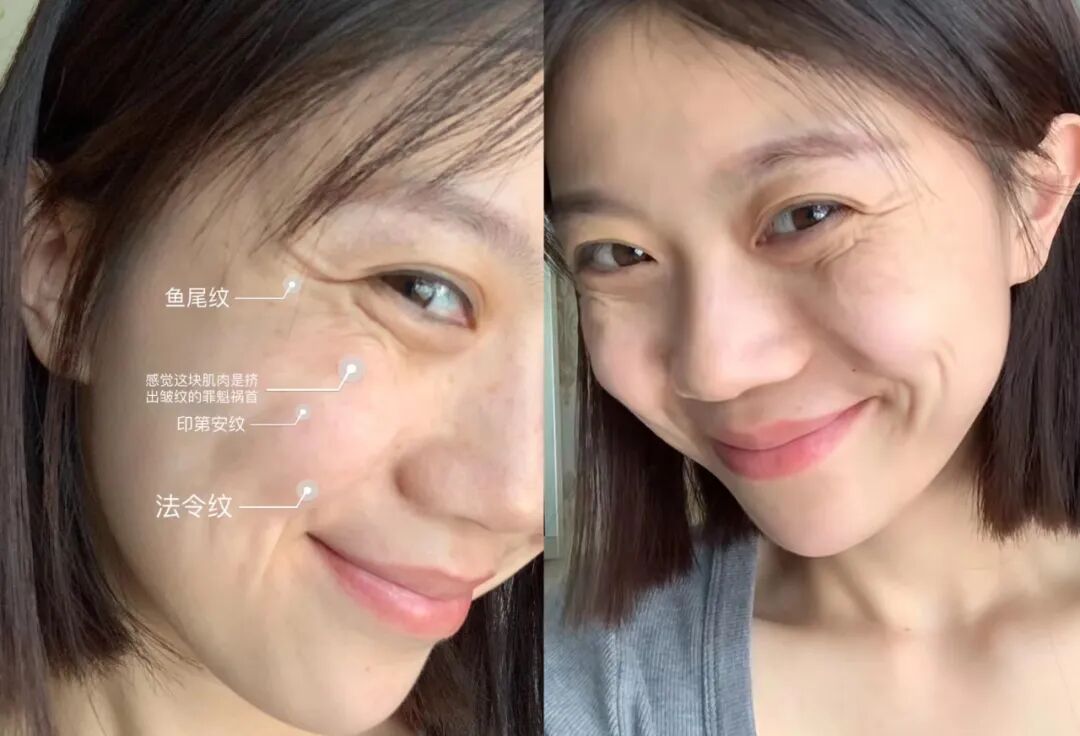 眼贴：440年眼药世家马应龙！