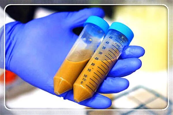 秃顶有救了？不过可能要吞屎才行...科学脑洞是无穷的（组图） - 13