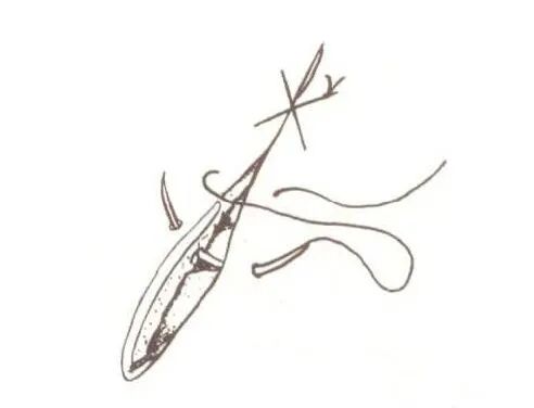 分离结扎钳怎么用【学生频道】外科手术基本功速成法，书上学不到的秘诀！（聂邯洛医师推荐）_https://www.jmylbn.com_新闻资讯_第39张