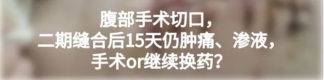 缝线怎么打结外科手术操作：打开手术通路之缝合打结_https://www.jmylbn.com_新闻资讯_第32张