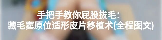 缝线怎么打结外科手术操作：打开手术通路之缝合打结_https://www.jmylbn.com_新闻资讯_第30张