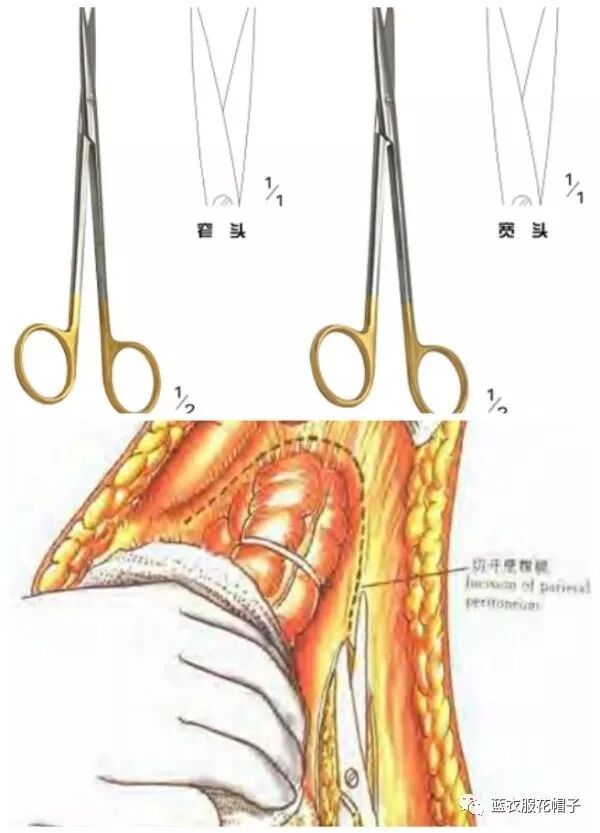卵圆钳怎么持胸外科手术器械大汇总_https://www.jmylbn.com_新闻资讯_第5张