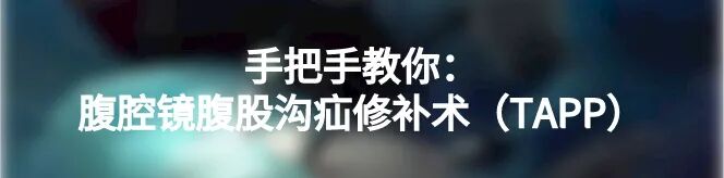 吻合器怎么用的一次性使用腔镜切割吻合器操作要点_https://www.jmylbn.com_新闻资讯_第21张