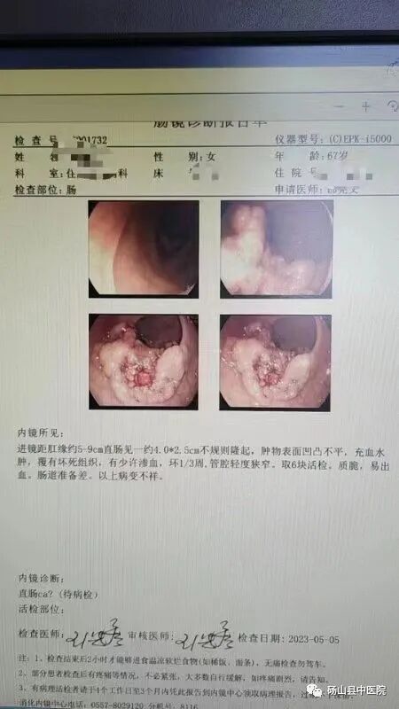 医讯怎么用【医讯】用心服务 用爱承诺——普外新势力--腔镜下手术_https://www.jmylbn.com_新闻资讯_第5张