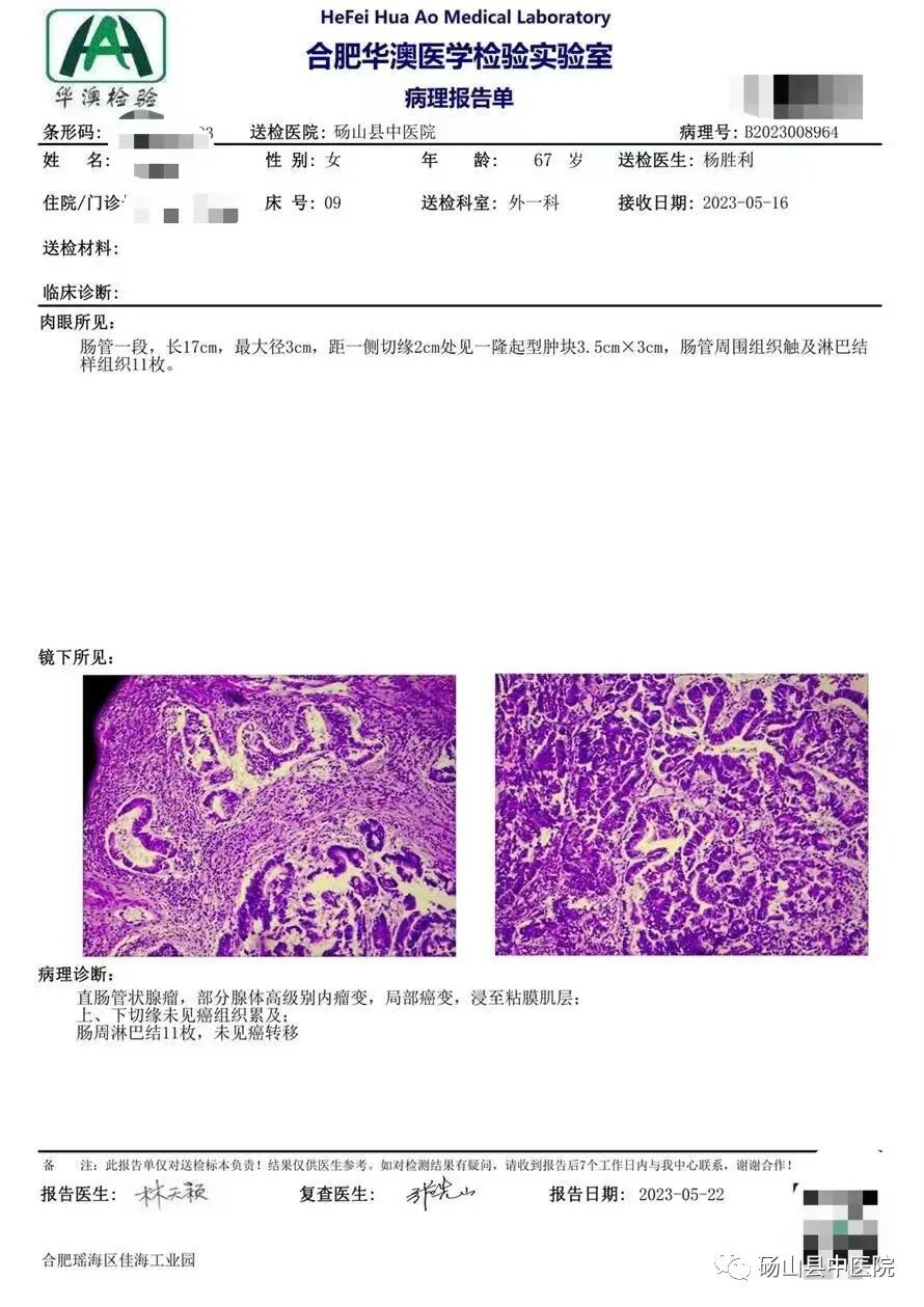 医讯怎么用【医讯】用心服务 用爱承诺——普外新势力--腔镜下手术_https://www.jmylbn.com_新闻资讯_第6张