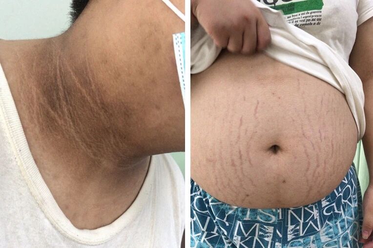 小明|【警惕】17岁男孩脖子发黑，身上阵阵异味！医生对爸妈直摇头：再不做这事就晚了