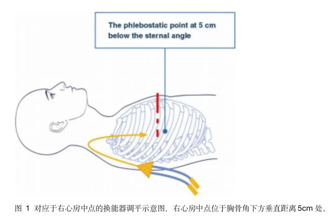 文献分享：中心静脉压