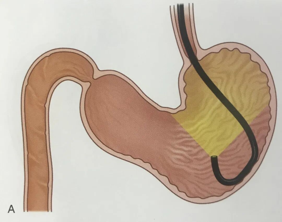 要想吃饱饱，就要胃好好！