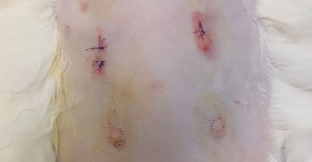 术后忧郁？不存在的！