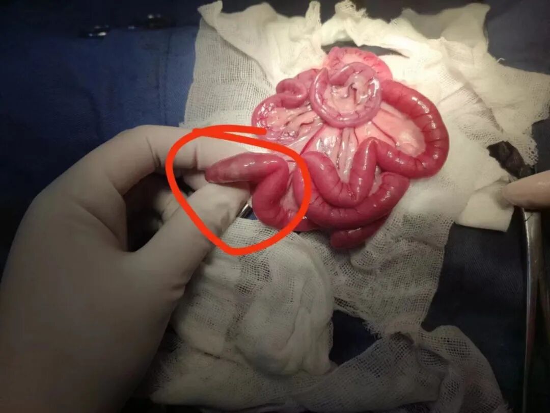 术后忧郁？不存在的！