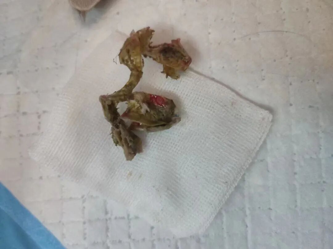 术后忧郁？不存在的！